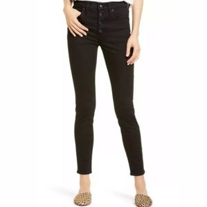 Madewell 9" Mid-Rise Button Front Skinny Jean